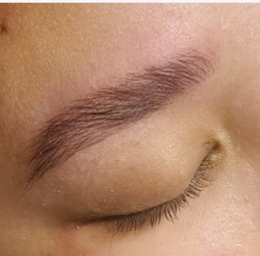 Formation Brow’s Lift